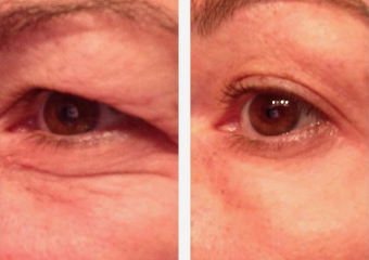 Spezial-Lifting-Creme für Augen,Gesicht und Hals